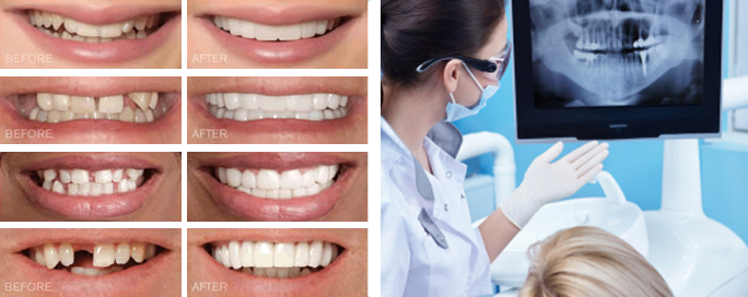 Before / after photo