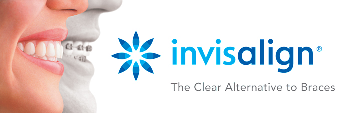 Invisalign